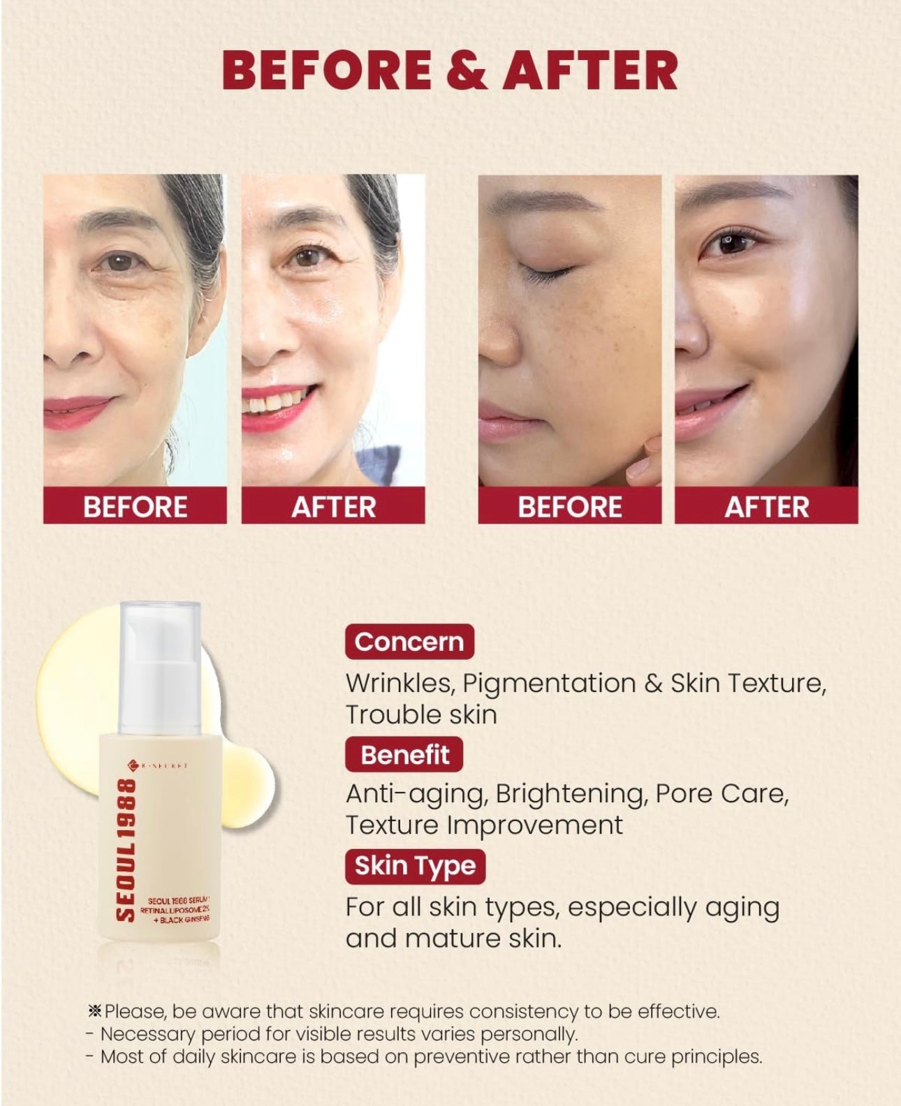 SEOUL 1988 - Retinal Liposome 2% + Black Ginseng