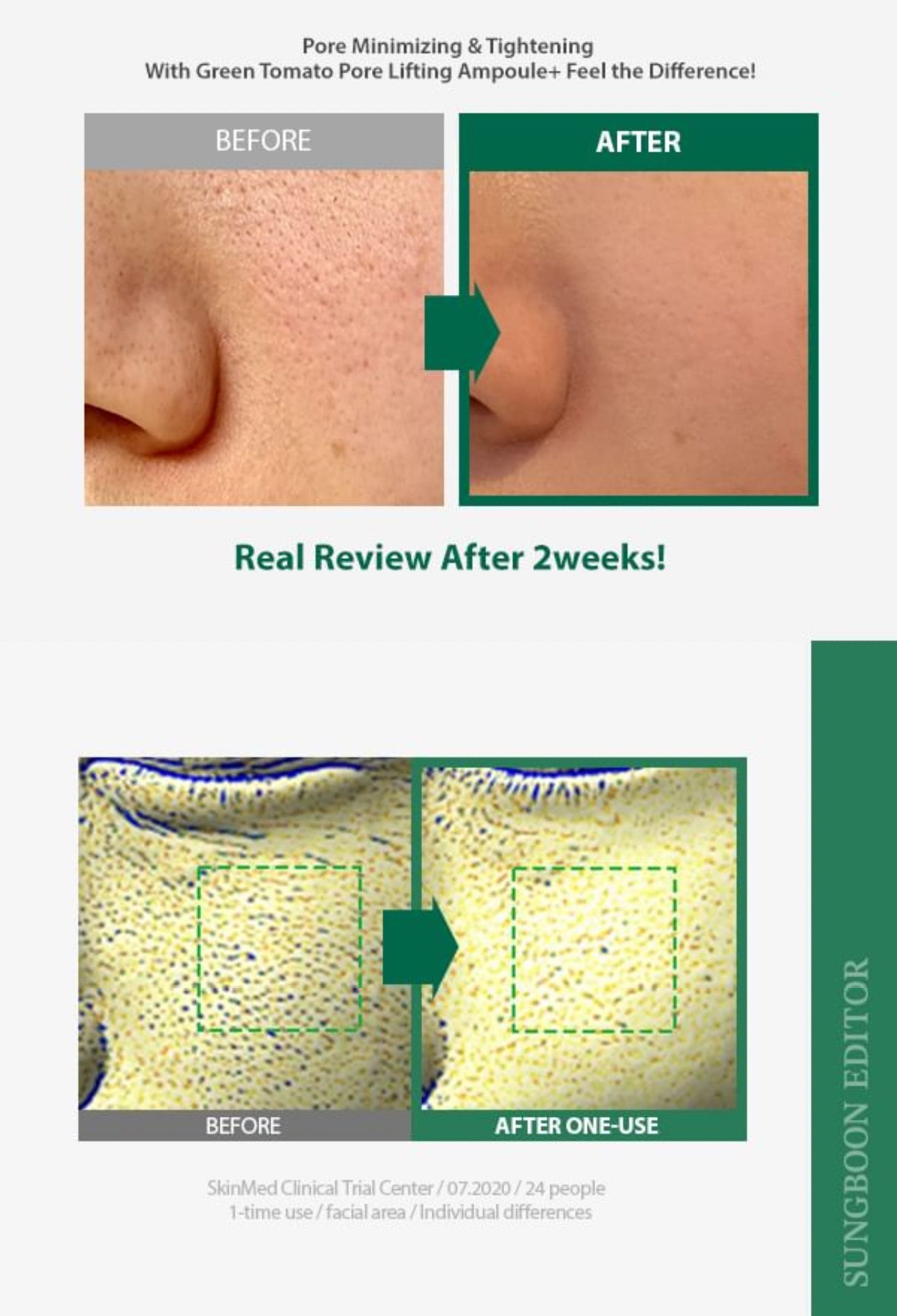 Sungboon Editor - Green Tomato Pore Lifting Ampoule