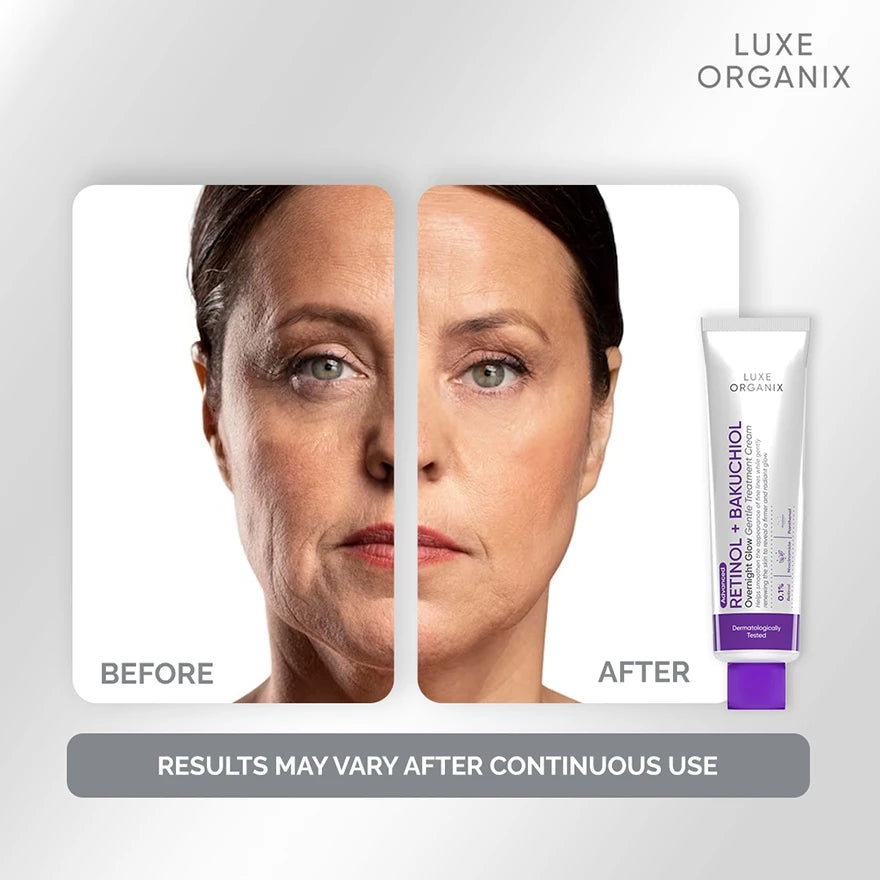 LUXE ORGANIX Advanced Retinol + Bakuchiol Overnight Glow Gentle Treatment Cream 30g