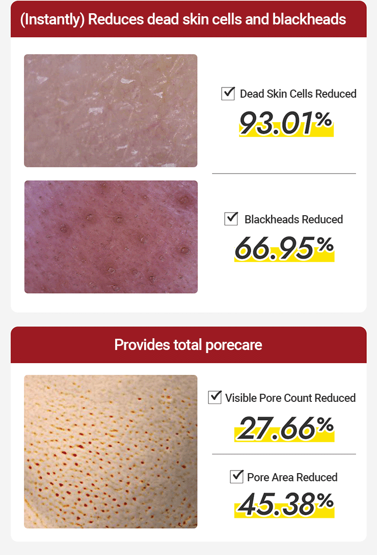 MEDIHEAL - Phyto Enzyme Peeling Pad
